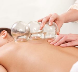 cupping lichaam